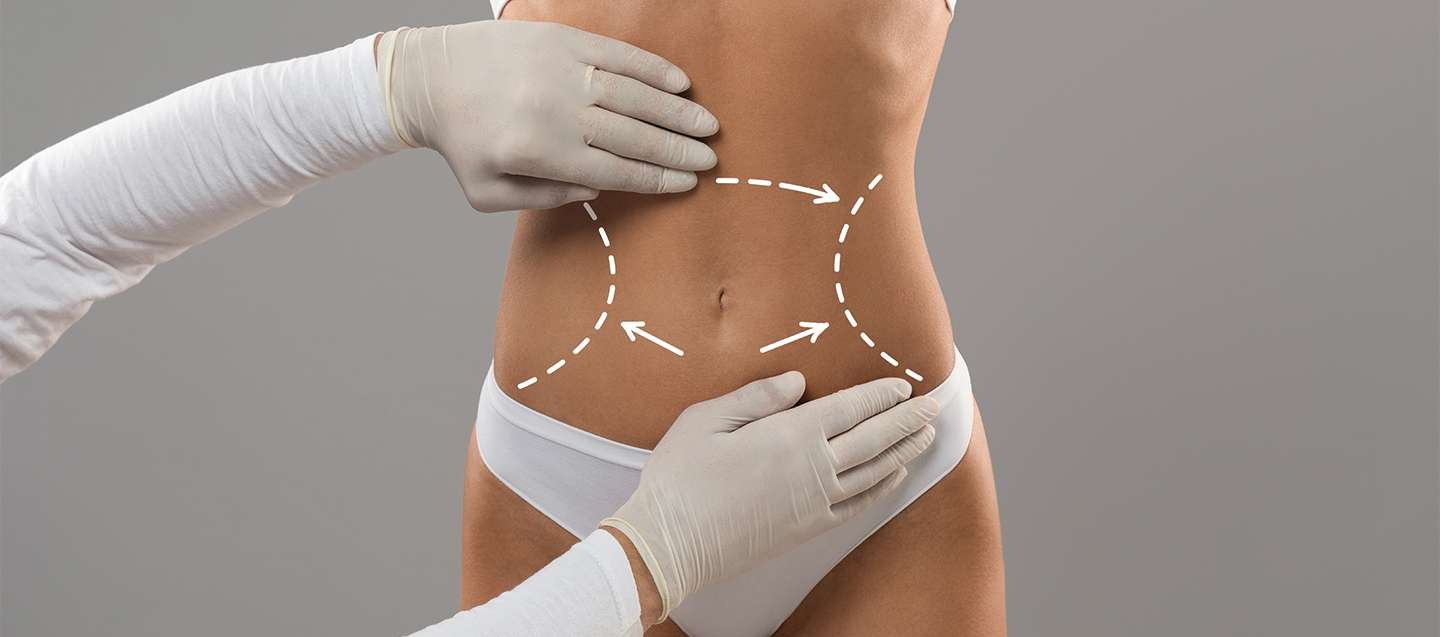 General Insights about Body Contouring Treatment - akruti
